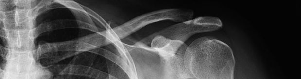 Images Kentucky Orthopaedics & Spine