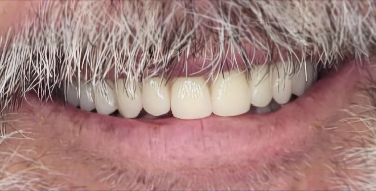 Images Damon Denture Designs Pty Ltd