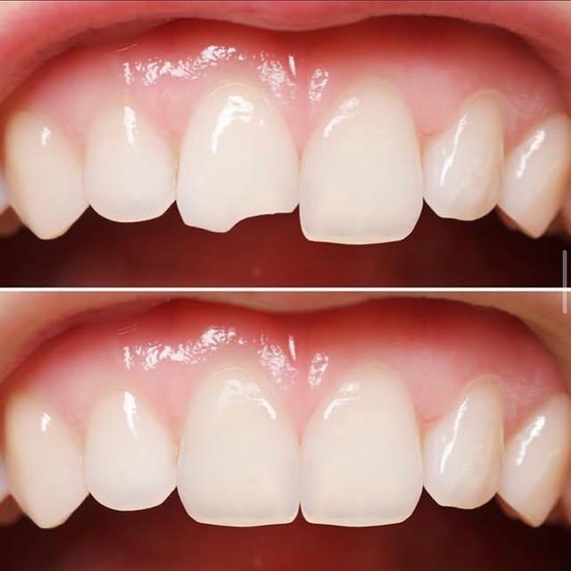 Images Smiles By Eddie: Dr. Edmond Ahdoot DDS
