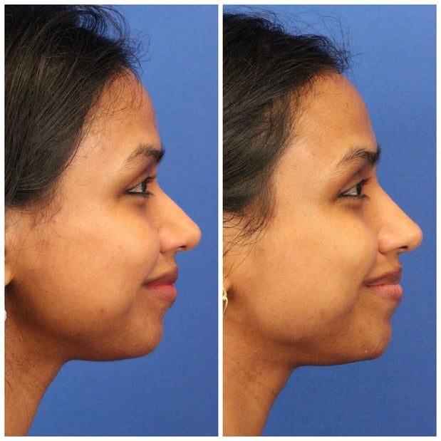 Images Dr. Sumit Bapna, MD