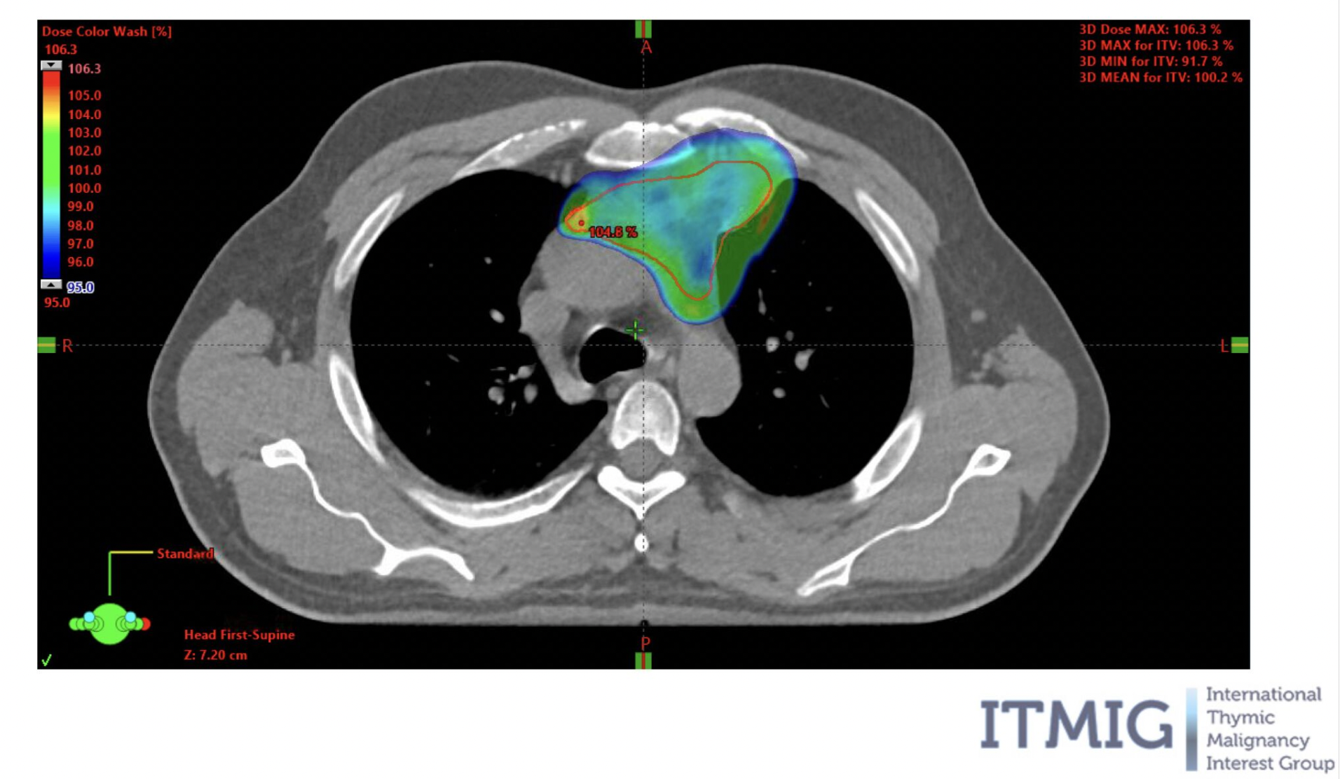 Images Dr James Wilson - Oncologist London
