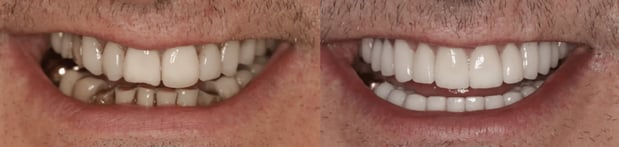 Images Iroquois Dentistry