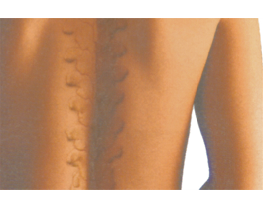 Massagepraxis A. Hellbach Inh. J. Kooi, Stepgesstr. 23 in Mönchengladbach