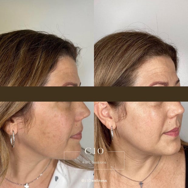 Images C10 Wellness and Rejuvenation