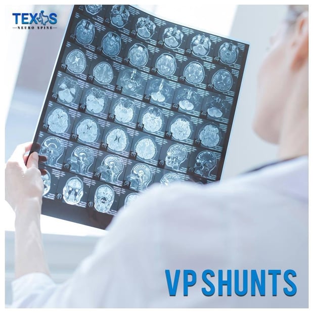 Images Texas Neuro Spine, Office of Dr. Michelle Cecchini