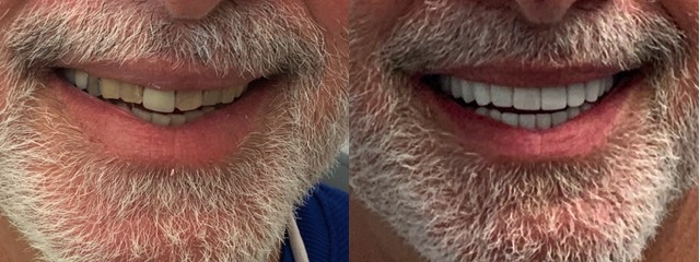 Images Marin Modern Dentistry