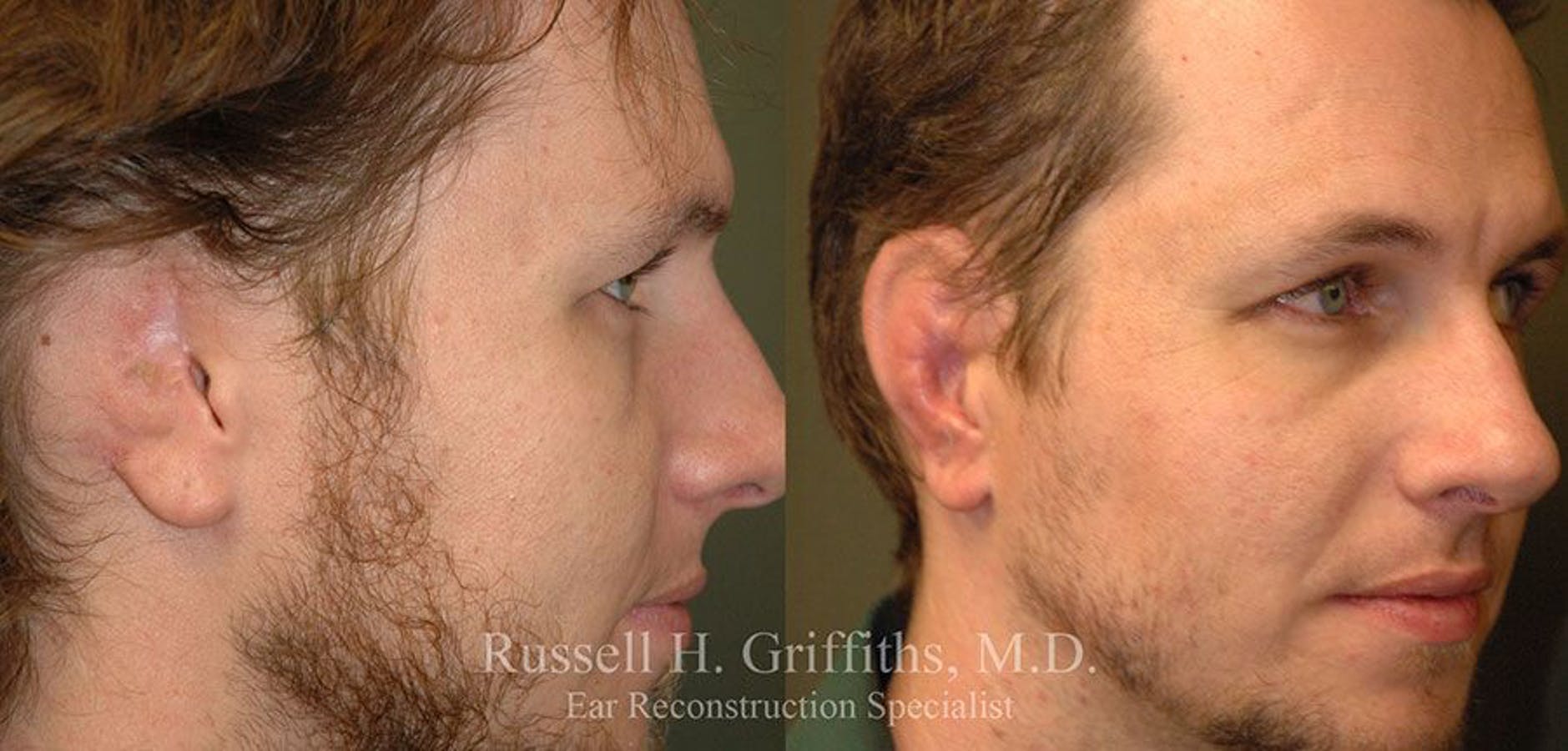 Results of Russell H. Griffiths, MD | Boise, ID