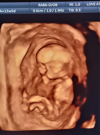 Images Love At First Sight 3D/4D Ultrasound Imaging Studio, LLC