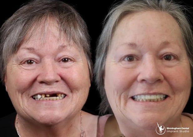 Images Birmingham Dental Implant Studio