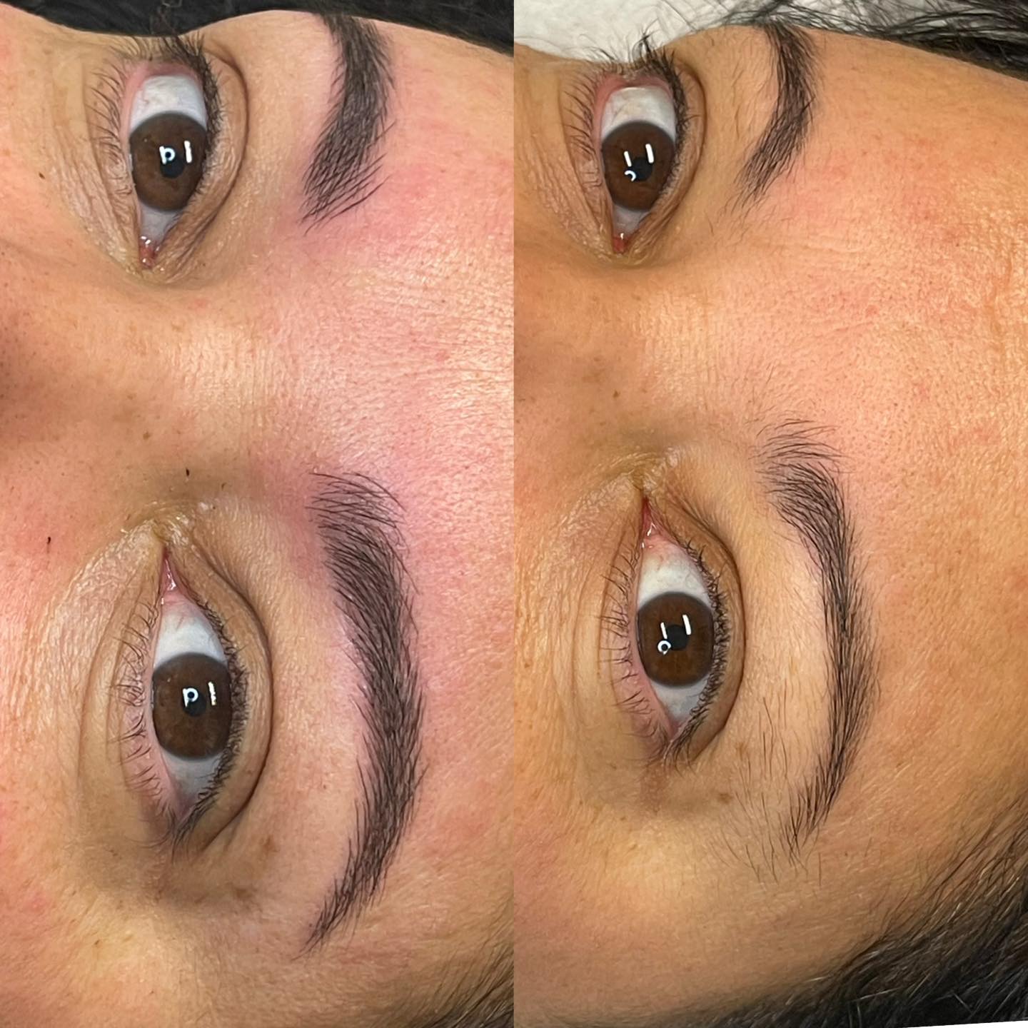 Images Clinique d'Esthétique Leila - Hydrafacial, Microblading, Épilation Laser Sainte-Foy