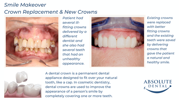 Images Absolute Dental
