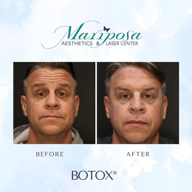 Images Mariposa Aesthetics & Laser Center