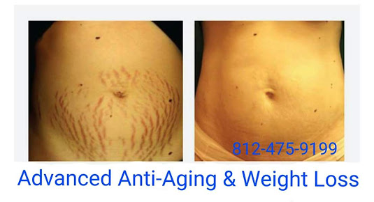 Advanced Anti-aging & Weight Loss Photo