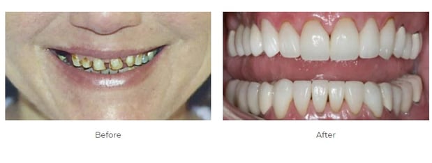 Images Aspen Ridge Dental