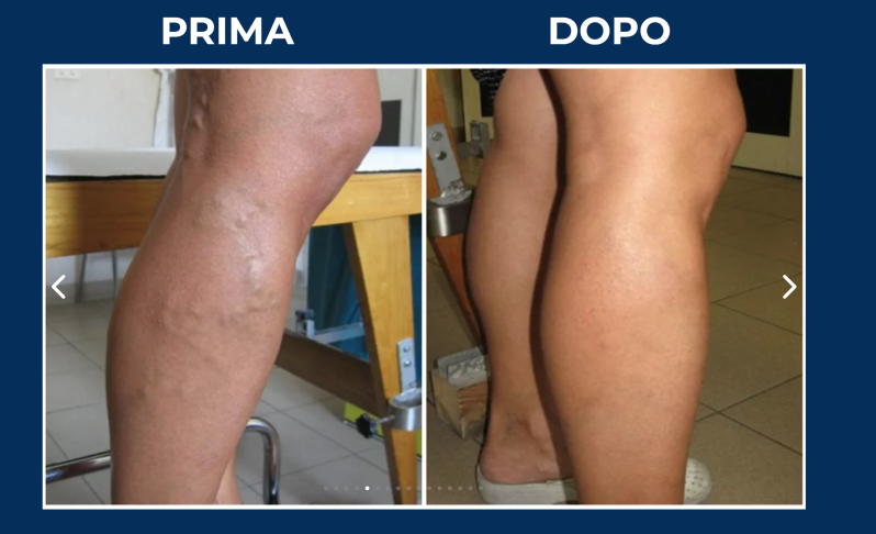 Images Dott. Massimo Gallucci | Specialista in Angiologia