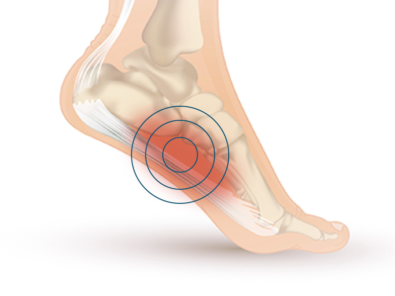 Cncrns_Cndtns-footpain-arch-392x294@2x.jpg