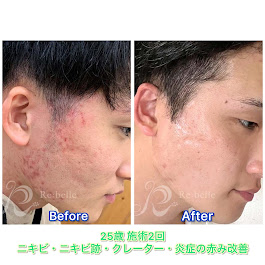 Images Blue beedro -メンズ美肌科学研究所-