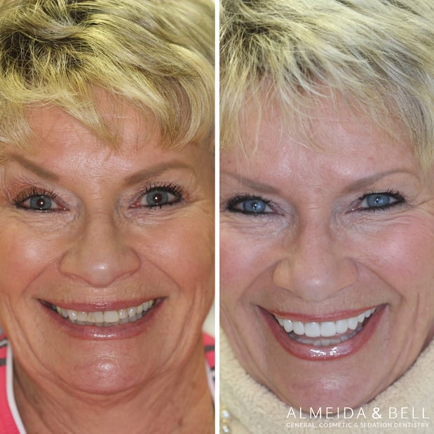 Images Almeida & Bell Dental Lone Tree - General, Cosmetic, and Implant Dentistry