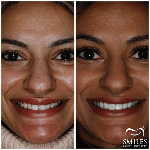 Images Brunswick Smiles Family Dentistry Implant, Oral Surgery, and Cosmetic Dentist