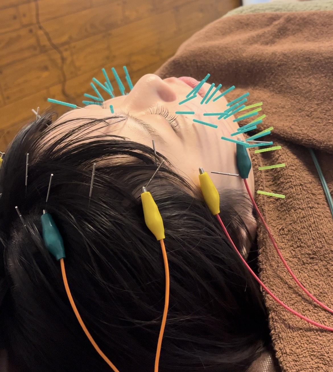 Images 鍼処MINAOSHI