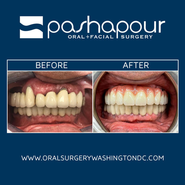 Images Pashapour Oral + Facial Surgery