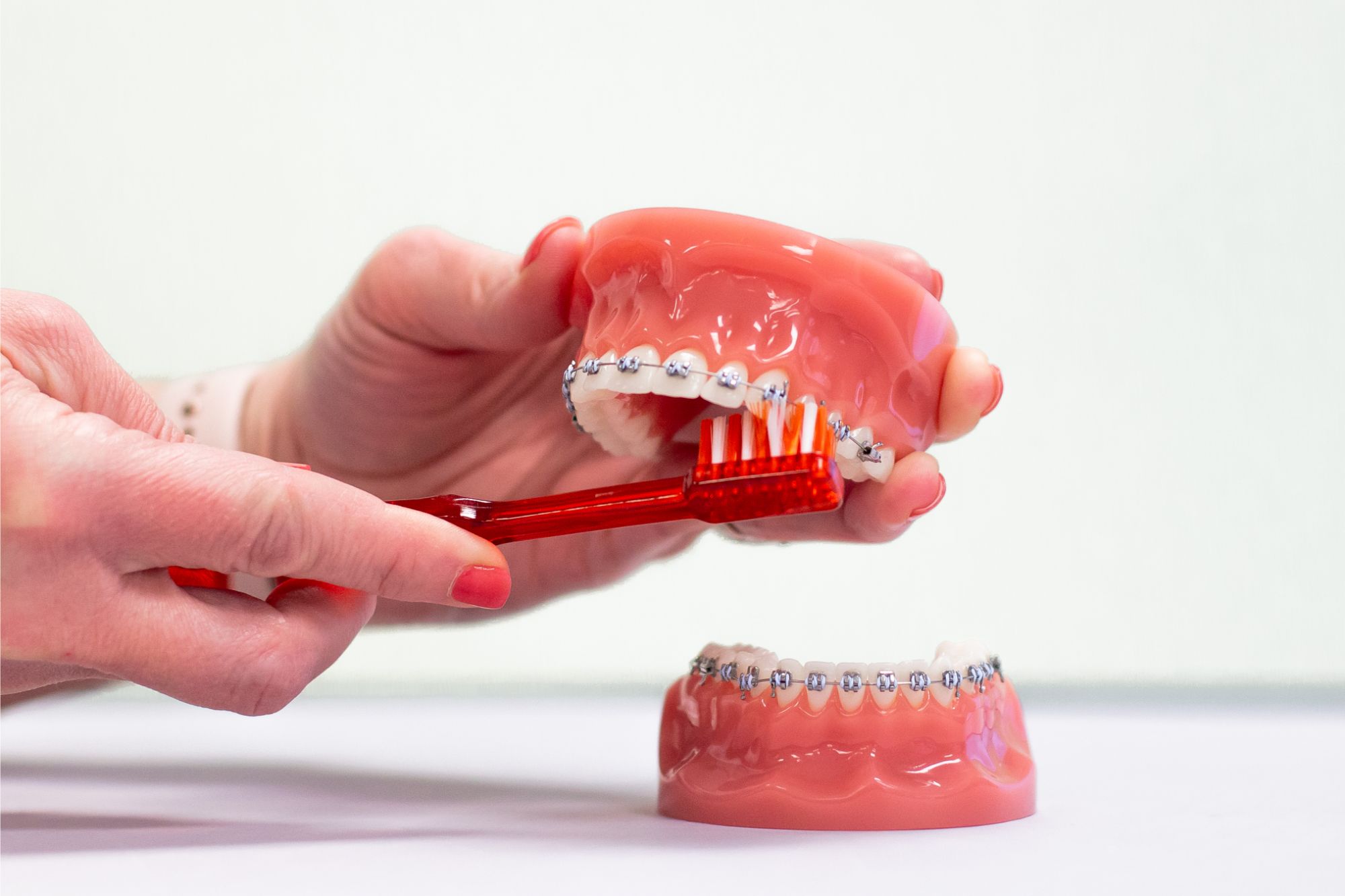 Proper brushing technique is essential for maintaining a healthy smile, especially with braces. Our team can show you the best way to keep your teeth clean and sparkling.