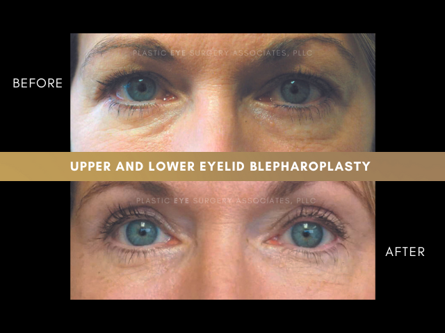 Images Plastic Eye Surgery Associates, PLLC