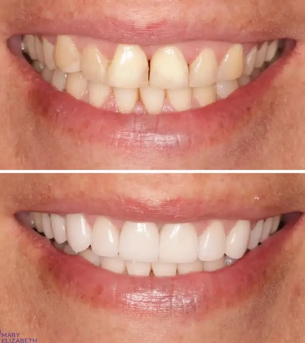 Images Mary Elizabeth Viechnicki, DMD