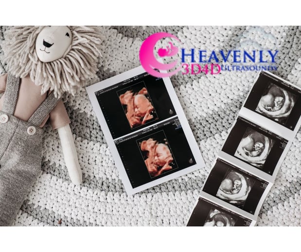 Images Heavenly 3D 4D Ultrasounds
