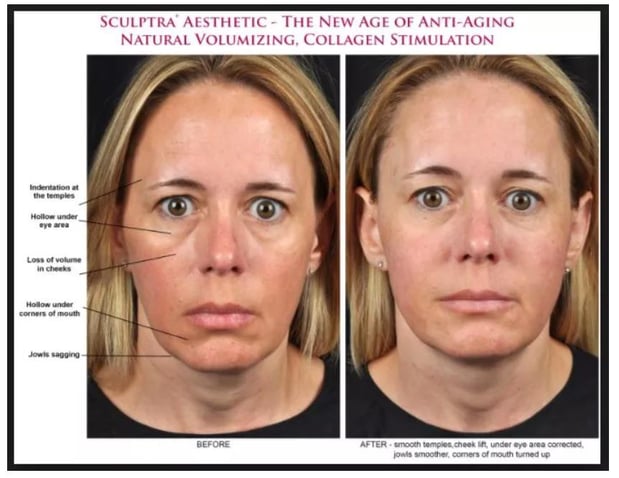 Images Renew Body Contouring & MedSpa