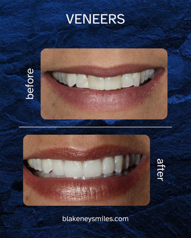 Images Advanced Dentistry of Blakeney