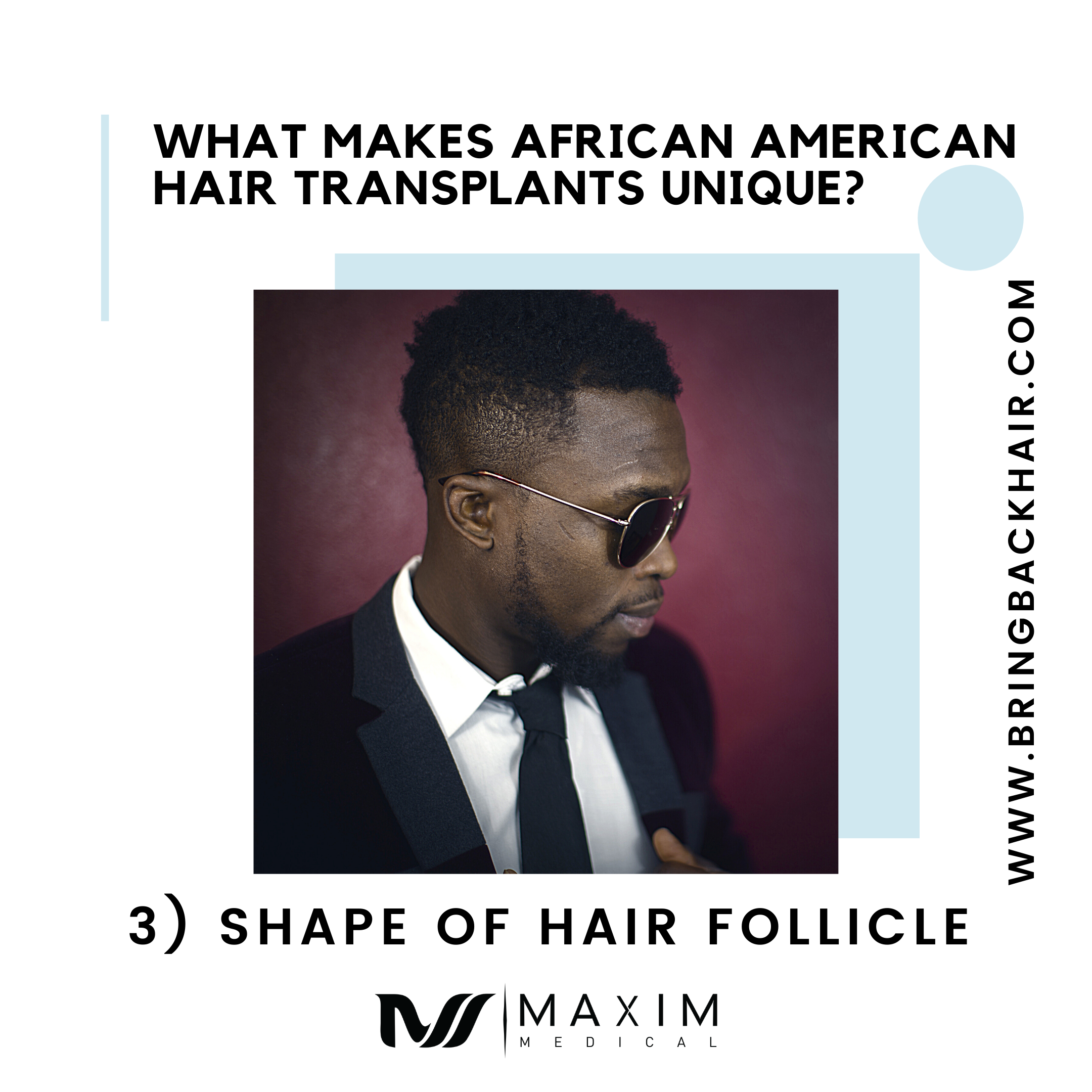 3. Shape of Hair Follicle

Though African American hair is technically less dense than other types of hair, it can appear to be thicker and more dense. This is due to the natural C-shaped curl of each follicle. This can actually serve to be an advantage for the patient when it comes to receiving a hair transplant as less hair from the donor area will be needed to be harvested to obtain a full appearance.