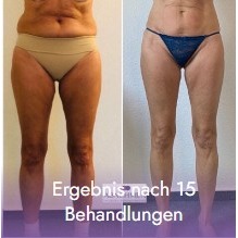 Beauty Holic und Abnehmen im Liegen in Stuttgart - Logo