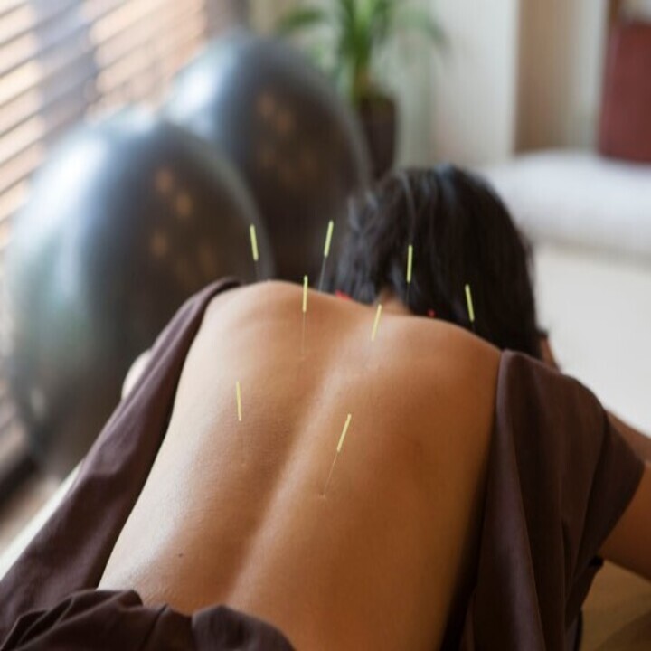 Images Apex Medical Acupuncture