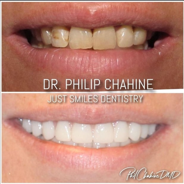 Images Just Smiles - General, Cosmetic & Implant Dentistry