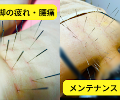 Images 鍼処KAKUREGA