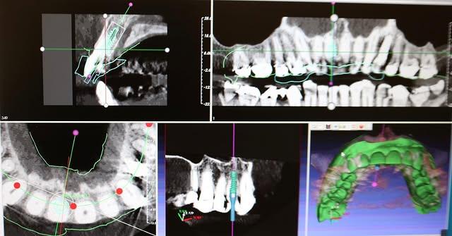 Images Smiles By Eddie: Dr. Edmond Ahdoot DDS