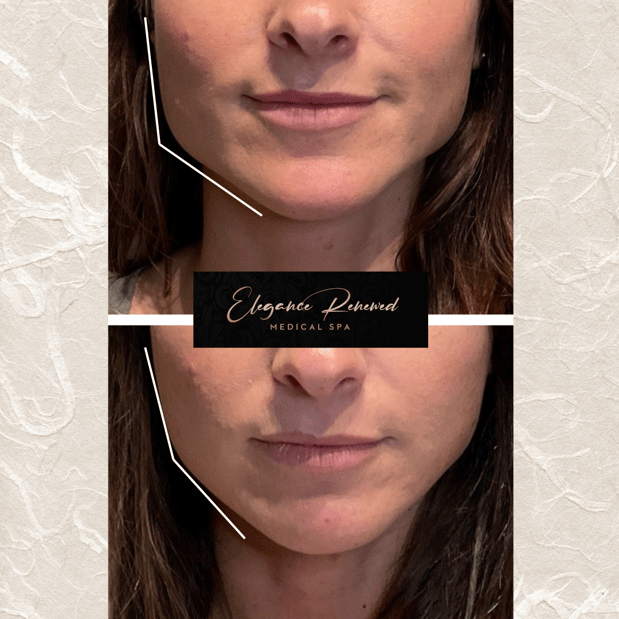 Images Elegance Renewed Medical Spa
