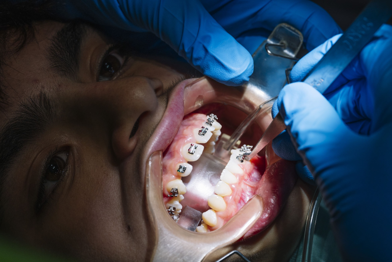 Images Croazia Dental Italia | Studio Dentistico | Vignola