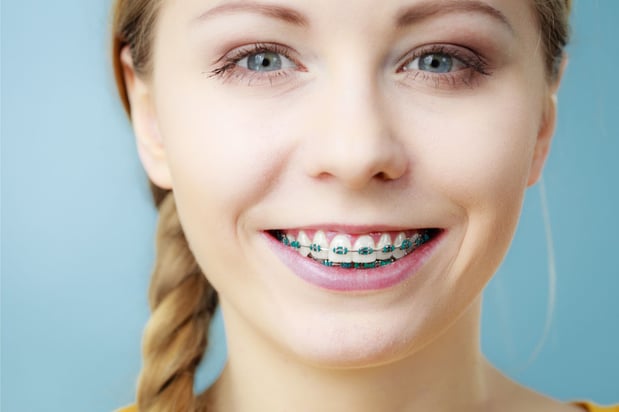 Images Smile Suite Orthodontics