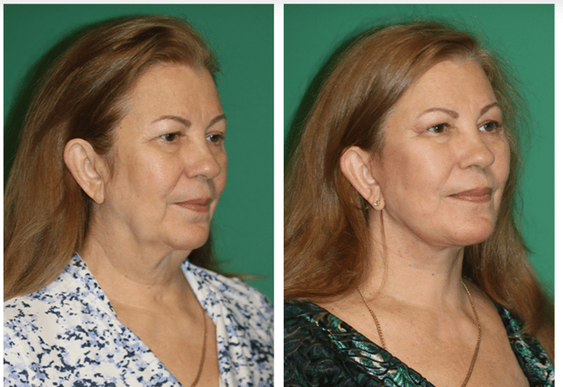 Images Dr. Sahar Nadimi