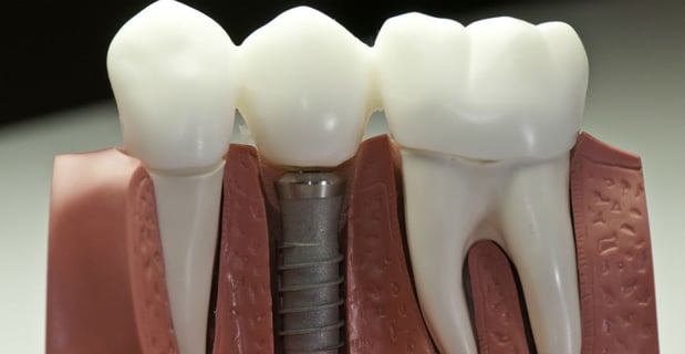 Images All About Teeth