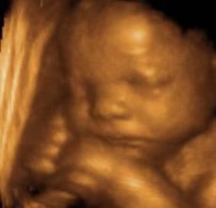 Images Fetal Memories 2D 3D 4D Ultrasound