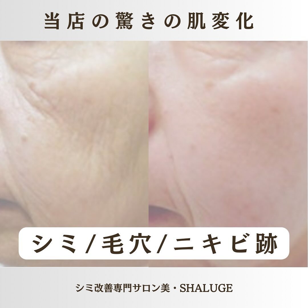 Images 美・SHALUGE