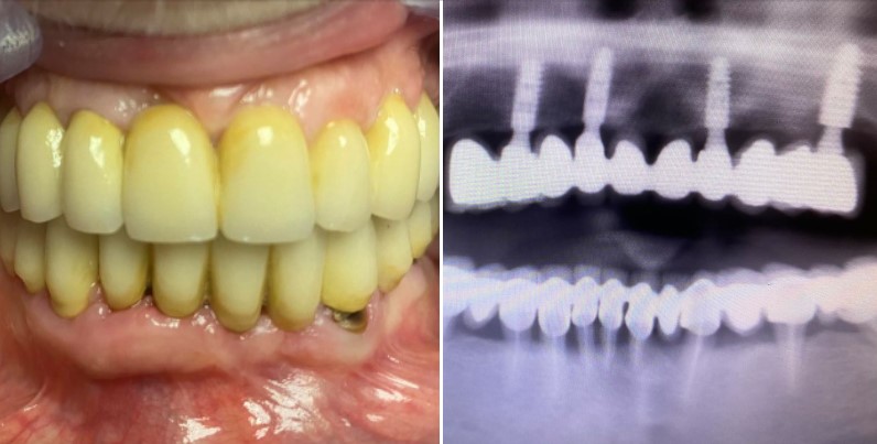 Images Studio Dentistico Dr. Michele Piombino