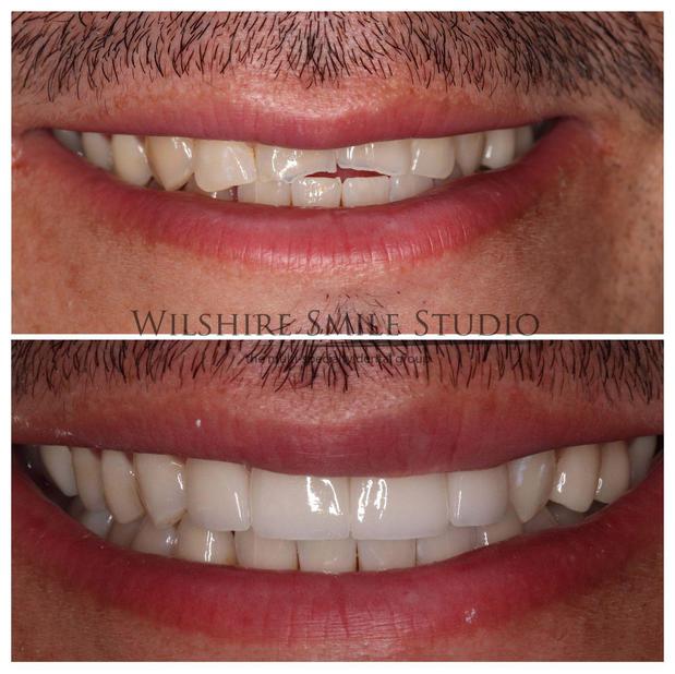 Images Wilshire Smile Studio