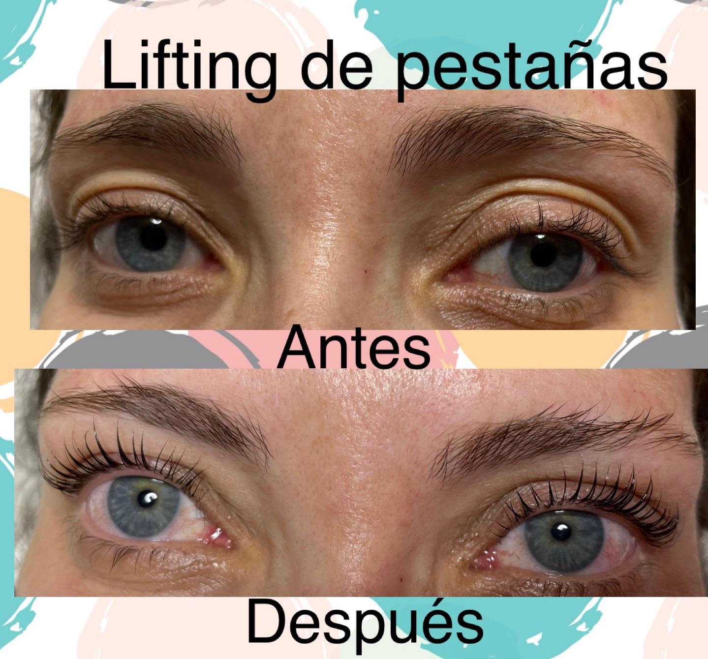 Images Centro De Estética Avanzada Y Láser Verónica Vico