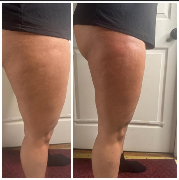 Images Sunkissed Med Spa