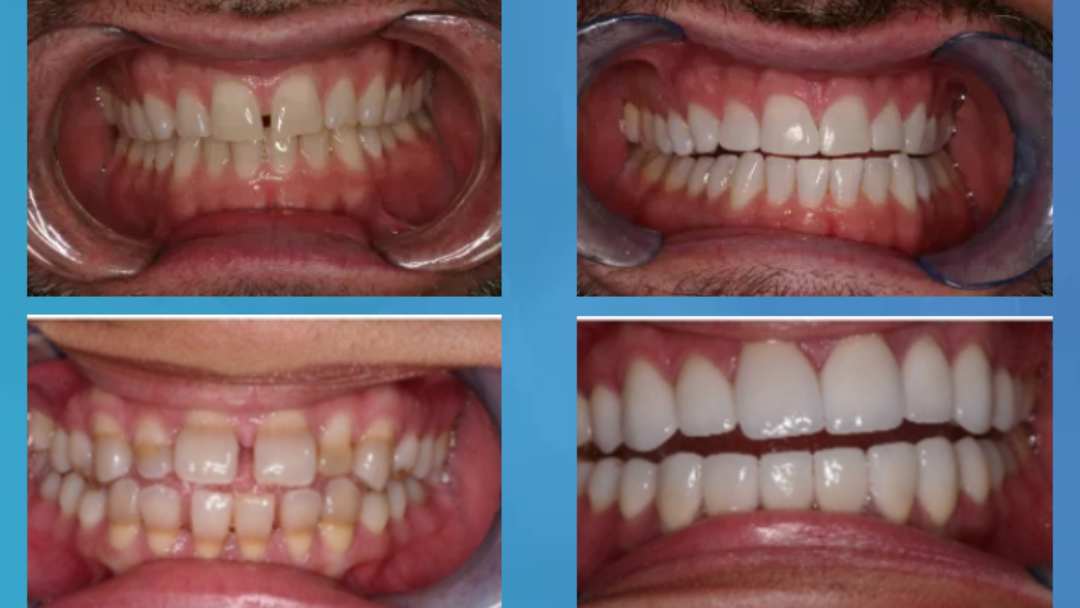 Image 5 | Modern Touch Dentistry