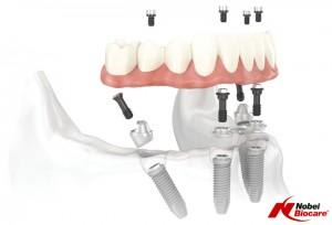 PH Clinical Dental Technician Kilmarnock 01563 521897